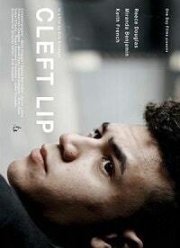 Заячья губа (2017)