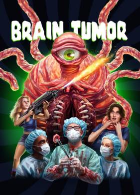 Опухоль мозга (2024)